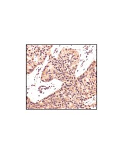 Cell Signaling Aps Antibody