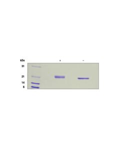 Cell Signaling Human Il-6 Recombinant Protein