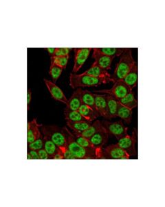 Cell Signaling Hausp (D17c6) Xp Rabbit mAb