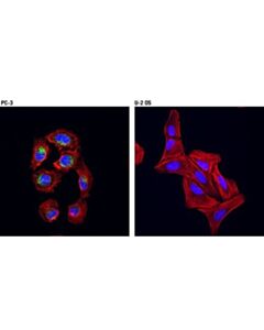 Cell Signaling Dkk1 (D5v6l) Rabbit mAb