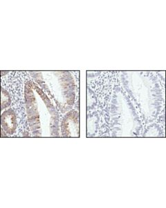 Cell Signaling Cox Iv Antibody