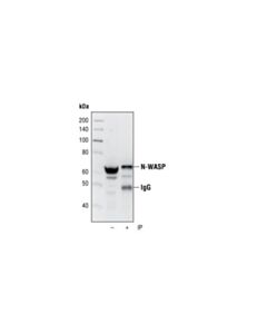 Cell Signaling N-Wasp (30d10) Rabbit mAb