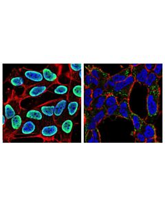 Cell Signaling Fus/Tls (E3o8i) Rabbit mAb (BSA And Azide Free)