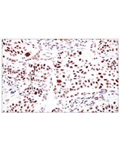 Cell Signaling Mettl14 (E2g9a) Rabbit mAb