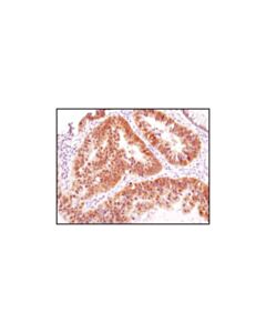 Cell Signaling Hsp40 (C64b4) Rabbit mAb