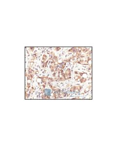 Cell Signaling Hsp70 Antibody