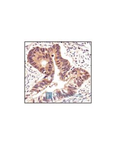 Cell Signaling Hsp90 Antibody