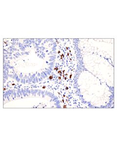 Cell Signaling Cd20 (E7b7t) Xp Rabbit mAb