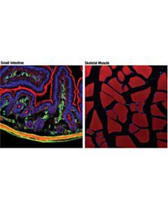 Cell Signaling Alpha-Smooth Muscle Actin (1a4) Mouse mAb (If Formulated)
