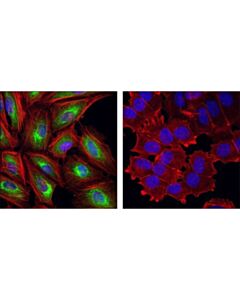 Cell Signaling Keratin 7 (R458) Antibody