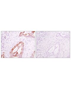 Cell Signaling Rabbit (DA1E) mAb IgG XP Isotype Control (BSA and Azide Free)