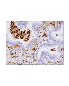 Cell Signaling Cd206/Mrc1 (E2l9n) Rabbit mAb (BSA And Azide Free)
