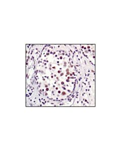 Cell Signaling 53bp1 Antibody