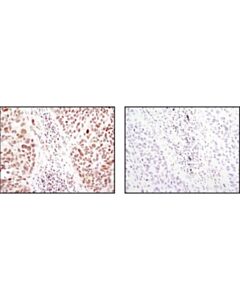 Cell Signaling Sumo-1 (C9h1) Rabbit mAb