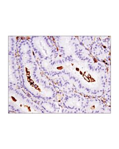 Cell Signaling Cd11b/Itgam (D6x1n) Rabbit mAb