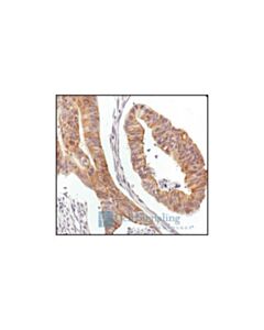 Cell Signaling Pbk/Topk Antibody