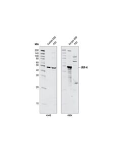 Cell Signaling Irf-4 (P173) Antibody