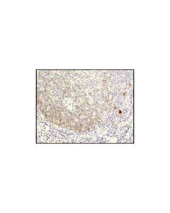 Cell Signaling Aid (Ek2 5g9) Rat mAb