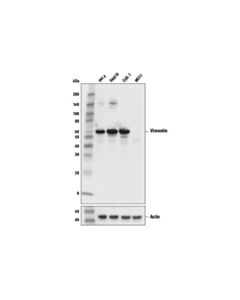 Cell Signaling Vimentin (V9) Mouse mAb