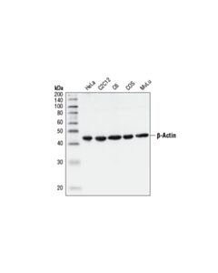 Cell Signaling Beta-Actin Antibody