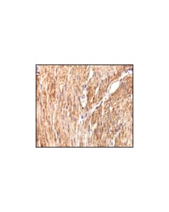 Cell Signaling Pan-Actin Antibody