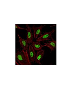Cell Signaling Sumo-2/3 (18h8) Rabbit mAb