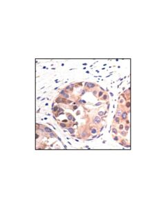 Cell Signaling Pabp1 Antibody
