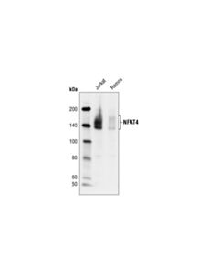 Cell Signaling Nfat4 Antibody