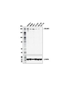 Cell Signaling Col4a1 Antibody