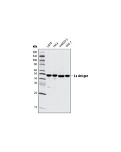 Cell Signaling La Antigen (D19B3) Rabbit mAb 20 uL