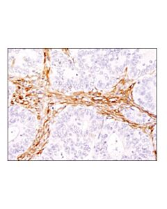 Cell Signaling Hsp27 (E1j4d) Rabbit mAb (Ihc Preferred)