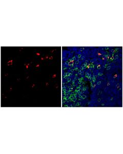 Cell Signaling Ctla-4 (E5s7e) Rabbit mAb