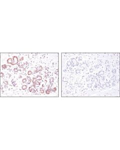 Cell Signaling Argonaute 1 (D84g10) Xp Rabbit mAb