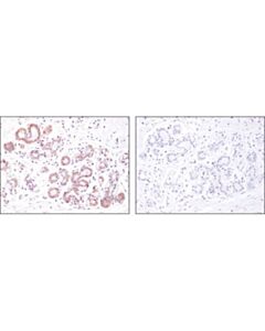 Cell Signaling Argonaute 1 (D84g10) Xp Rabbit mAb