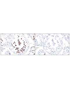 Cell Signaling Sgo2 (E9k4n) Rabbit mAb