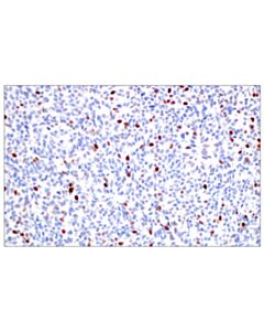Cell Signaling Brca1 (E5s9g) Rabbit mAb