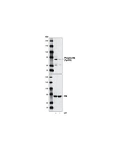 Cell Signaling Phospho-Btk (Tyr223) Antibody