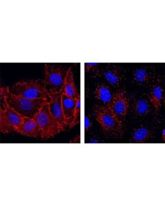 Cell Signaling Egf Receptor (D38b1) Xp Rabbit mAb (Alexa Fluor 555 Conjugate)