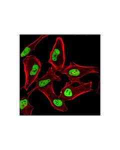 Cell Signaling Hdac2 (3f3) Mouse mAb