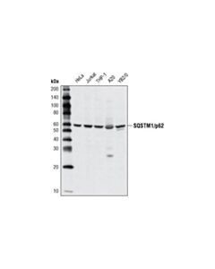Cell Signaling Sqstm1/P62 Antibody