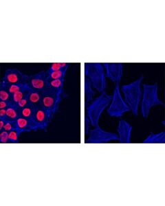 Cell Signaling Sox2 (D6d9) Xp Rabbit mAb (Alexa Fluor 555 Conjugate)