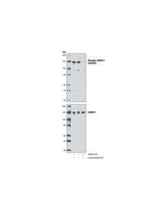 Cell Signaling Phospho-Card11 (Ser652) Antibody