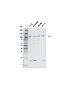 Cell Signaling Ect2 (E7v4l) Rabbit mAb