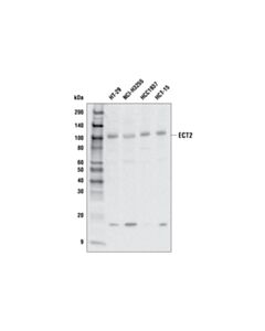 Cell Signaling ECT2 (E7V4L) Rabbit mAb 20 uL