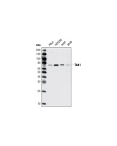 Cell Signaling Tak1 (D94d7) Rabbit mAb
