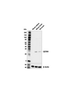 Cell Signaling Gstm1 Antibody