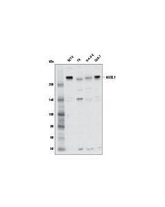 Cell Signaling Asxl1 (D1b6v) Rabbit mAb