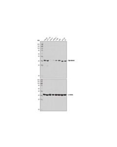 Cell Signaling Aprataxin (D5p3c) Rabbit mAb