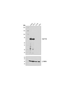 Cell Signaling Slp-76 (D1r1a) Rabbit mAb (BSA And Azide Free)
