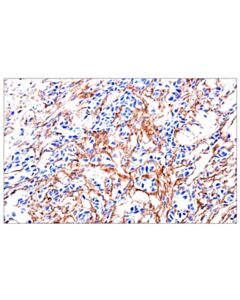 Cell Signaling FAP (F1A4G) Rabbit mAb